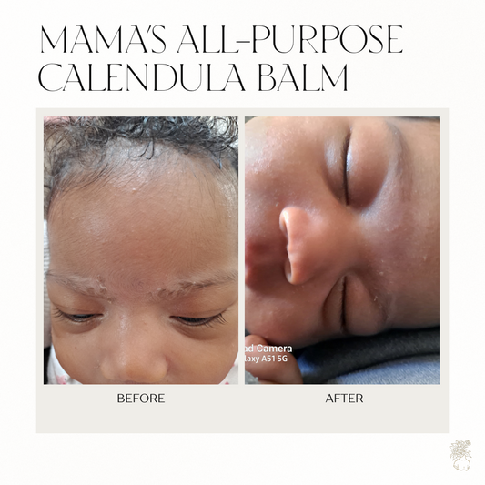 Your Gentle Solution to Cradle Cap